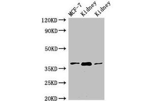 Western Blot Positive WB detected in: MCF-7 whole cell lysate, Rat kidney tissue, Mouse kidney tissue All lanes: HAO2 antibody at 3 μg/mL Secondary Goat polyclonal to rabbit IgG at 1/50000 dilution Predicted band size: 39, 41 kDa Observed band size: 39 kDa