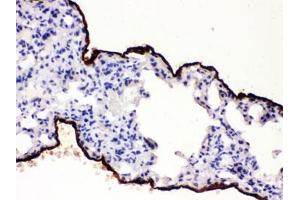 IHC testing of FFPE mouse lung with Mesothelin antibody. (Mesothelin antibody  (AA 308-576))