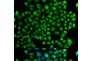 Immunofluorescence analysis of A549 cells using ZFYVE1 Polyclonal Antibody (ZFYVE1 antibody)