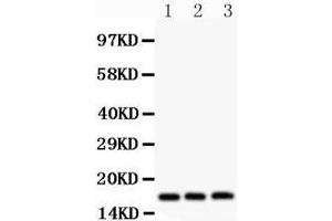 Western Blotting (WB) image for anti-Fragile Histidine Triad (FHIT) (AA 1-147) antibody (ABIN3042392) (FHIT antibody  (AA 1-147))