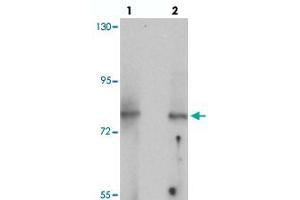 Western blot analysis of UHRF1BP1 in mouse kidney tissue with UHRF1BP1 polyclonal antibody  at (lane 1) 1 and (lane 2) 2 ug/mL. (UHRF1BP1 antibody  (Internal Region))