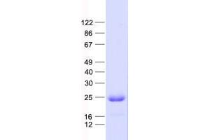 Validation with Western Blot (FAM119A Protein (His tag))