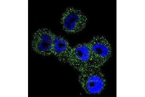 Immunofluorescence (IF) image for anti-serpin Peptidase Inhibitor, Clade B (Ovalbumin), Member 5 (SERPINB5) antibody (ABIN2996527)