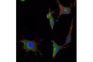 Immunofluorescence analysis of NTERA-2 cells using SMAD5 mouse mAb (green). (SMAD5 antibody)