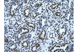 Rabbit Anti-HMGN1 Antibody       Paraffin Embedded Tissue:  Human alveolar cell   Cellular Data:  Epithelial cells of renal tubule  Antibody Concentration:   4. (HMGN1 antibody  (Middle Region))