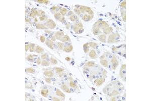 Immunohistochemistry of paraffin-embedded human stomach using MSMB antibody (ABIN6003799) at dilution of 1/100 (40x lens).