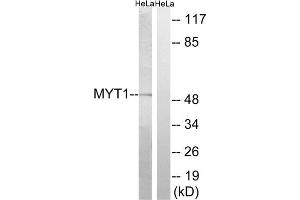 Western blot analysis of extracts from HeLa cells, using MYT1 (epitope around residue 83) antibody. (MYT1 antibody  (Ser83))