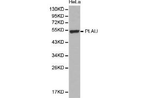 Western Blotting (WB) image for anti-Plasminogen Activator, Urokinase (PLAU) (AA 20-180) antibody (ABIN3023142) (PLAU antibody  (AA 20-180))