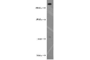 Western Blotting (WB) image for anti-Xin Actin-Binding Repeat Containing 2 (XIRP2) antibody (ABIN2906145) (XIRP2 antibody)