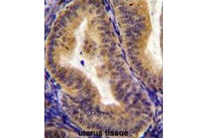 Immunohistochemistry (Paraffin-embedded Sections) (IHC (p)) image for anti-Interleukin 6 Signal Transducer (Gp130, Oncostatin M Receptor) (IL6ST) (AA 878-906), (C-Term) antibody (ABIN951186)