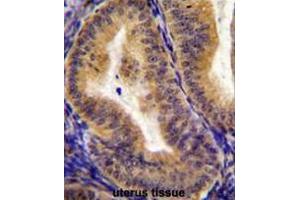 CD130 Antibody (C-term) immunohistochemistry analysis in formalin fixed and paraffin embedded human uterus tissue followed by peroxidase conjugation of the secondary antibody and DAB staining. (CD130/gp130 antibody  (C-Term))