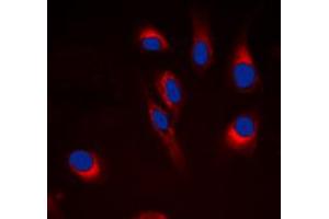 Immunofluorescent analysis of Cytochrome P450 21A2 staining in Hela cells. (CYP21A2 antibody  (Center))