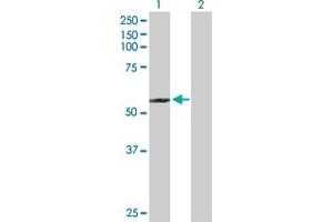 Western Blot analysis of SUFU expression in transfected 293T cell line by SUFU MaxPab polyclonal antibody. (SUFUH antibody  (AA 1-484))