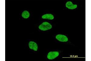 Immunofluorescence of monoclonal antibody to ATF2 on HeLa cell. (ATF2 antibody)