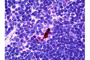 Anti-EBI3 antibody IHC of human lymphoid-dendritic cells. (EBI3 antibody)