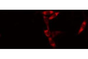 ABIN6274586 staining HuvEc cells by IF/ICC. (AIM2 antibody  (Internal Region))