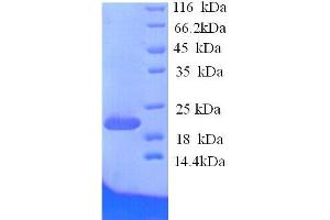 Ephrin A1 (EFNA1) (AA 18-182), (full length) protein (His tag) (Ephrin A1 Protein (EFNA1) (AA 18-182, full length) (His tag))