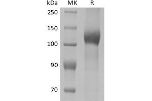 Western Blotting (WB) image for Leptin Receptor (LEPR) protein (His tag) (ABIN7320898) (Leptin Receptor Protein (LEPR) (His tag))