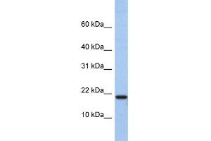 WB Suggested Anti-C1D Antibody Titration:  0. (C1D antibody  (N-Term))