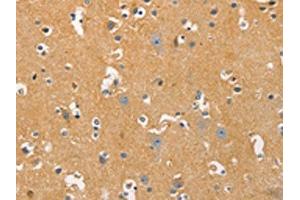 The image on the left is immunohistochemistry of paraffin-embedded Human brain tissue using ABIN7129239(DNM3 Antibody) at dilution 1/20, on the right is treated with fusion protein. (Dynamin 3 antibody)