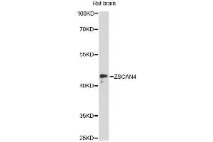 Western blot analysis of extracts of rat brain, using ZSCAN4 antibody (ABIN6293838) at 1:3000 dilution. (ZSCAN4 antibody)
