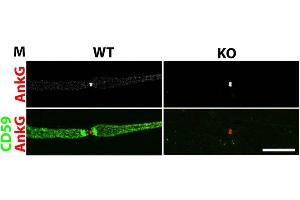 anti-Ankyrin 3, Node of Ranvier (Ankyrin G) (ANK3) antibody