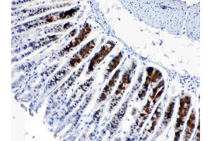 IHC analysis of CD166/ALCAM using anti- CD166/ALCAM antibody . (CD166 antibody  (AA 167-406))