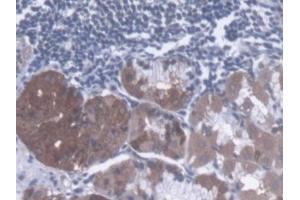 DAB staining on IHC-P; Samples: Human Stomach Tissue (Dystonin antibody  (AA 1-252))