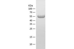 Stress-Induced-phosphoprotein 1 (STIP1) (AA 1-543) protein (His tag)
