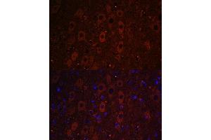 Immunofluorescence analysis of mouse brain using RUSC1 antibody (ABIN7270114) at dilution of 1:100. (RUSC1 antibody  (AA 1-320))