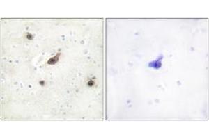 Immunohistochemistry analysis of paraffin-embedded human brain tissue, using B-RAF Antibody. (SNRPE antibody  (AA 171-220))