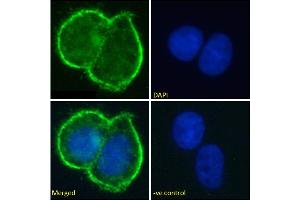Immunofluorescence (IF) image for anti-Mucin 1 (MUC1) antibody (ABIN5668231)