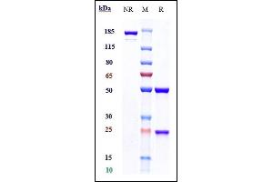 Anti-FGFR3 / CD333 Reference Antibody (vofatamab) on SDS-PAGE under reducing (R) condition. (Recombinant FGFR3 (Vofatamab Biosimilar) antibody)