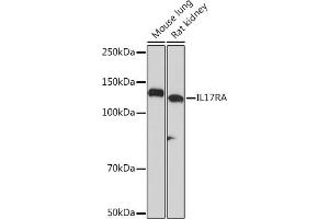 Western blot analysis of extracts of various cell lines, using IL17RA Rabbit mAb (ABIN7267989) at 1:1000 dilution. (IL17RA antibody)