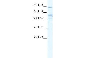 WB Suggested Anti-CHRNB2 Antibody Titration:  5. (CHRNB2 antibody  (Middle Region))