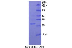 SDS-PAGE analysis of Pig NOS3 Protein.