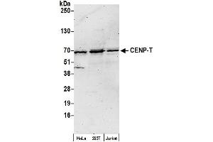 anti-Centromere Protein T (CENPT) (AA 480-520) antibody