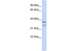 WB Suggested Anti-HYLS1 Antibody Titration: 0. (HYLS1 antibody  (Middle Region))