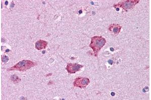 Human Brain, Cortex: Formalin-Fixed, Paraffin-Embedded (FFPE) (HGF antibody  (AA 216-265))