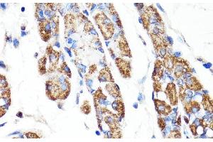 Immunohistochemistry of paraffin-embedded Human stomach using RNF149 Polyclonal Antibody at dilution of 1:100 (40x lens). (RNF149 antibody)
