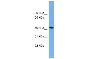 MAPT antibody used at 1 ug/ml to detect target protein.