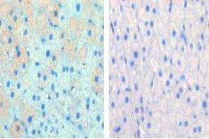 IHC data of FFPE cow lactation tissue tested with CPT1A antibody (left) and without primary Ab (right). (CPT1A antibody  (AA 606-636))