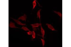ABIN6277268 staining 293 by IF/ICC. (PAK1 antibody  (N-Term))