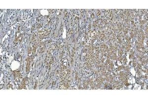 IHC analysis of GRX2/GLRX2 using anti-GRX2/GLRX2 antibody (ABIN7599022).