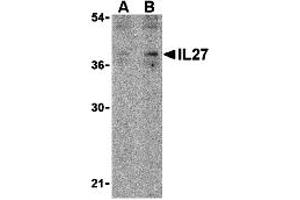 Western Blotting (WB) image for anti-Interleukin 27 (IL27) (N-Term) antibody (ABIN1031413) (IL-27 antibody  (N-Term))