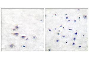 Immunohistochemistry (IHC) image for anti-SHC (Src Homology 2 Domain Containing) Transforming Protein 1 (SHC1) (pTyr427) antibody (ABIN1847216) (SHC1 antibody  (pTyr427))