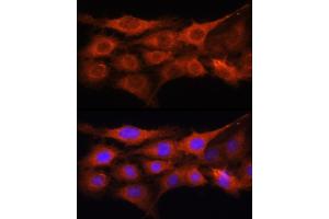 Immunofluorescence analysis of C6 cells using GALNS Rabbit pAb (ABIN6131691, ABIN6140937, ABIN6140938 and ABIN6221120) at dilution of 1:100 (40x lens). (GALNS antibody  (AA 353-522))