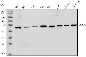 Western blot analysis of MAP3K8 using anti-MAP3K8 antibody (ABIN4886663). (MAP3K8 antibody  (AA 9-193))