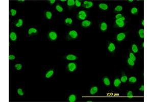Immunofluorescence of monoclonal antibody to YY1 on HeLa cell. (YY1 antibody  (AA 221-320))
