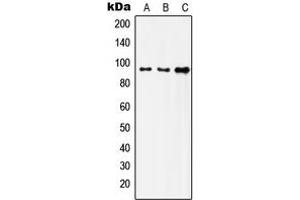 Western blot analysis of Insulin Receptor expression in HeLa (A), SKOV3 (B), HepG2 (C) whole cell lysates. (Insulin Receptor antibody  (C-Term))